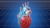 Large geographic variation seen with heart failure phenotypes