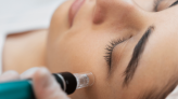 Fillers can give the desired look—follow these dos and don’ts