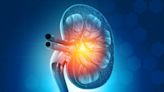 Research indicates kidneys from deceased donors who were on dialysis are suboptimal