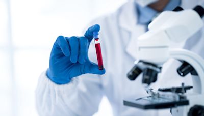 FDA approves new blood test for colon cancer screening: ‘Early detection is critical’