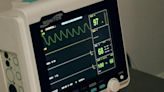 Cofepris autoriza este software para tratamiento de infarto al miocardio