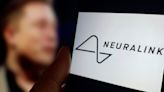 Neuralink Reveals Issues With First Human Brain Implant After Surgery