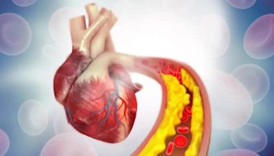 World Heart Day 2024: How high cholesterol, microplastics are contributing to rising heart diseases