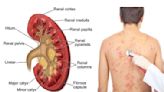 台灣「慢性腎病」發作率世界第一，「十種身體徵兆」表示你的腎正在崩壞！ | 蕃新聞