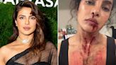 Priyanka Chopra Ditches Glam in Bloody Behind-the-Scenes Look at Action Movie: 'Another Day at the Office'