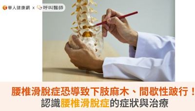 腰椎滑脫症恐導致下肢麻木、間歇性跛行！認識腰椎滑脫症的症狀與治療 | 蕃新聞