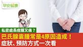 「妹妹」長一包腫又痛，可能是囊腫惹禍？常見4原因馬上看懂