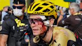 Sepp Kuss blooded and bandaged after crash but finishes Tour de France stage 20