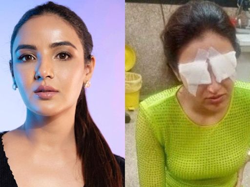 Jasmin Bhasin Is 'Feeling Worst' Due To Corneal Damage, Talks About 'Excruciating Pain and No Vision' - News18