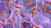 La OMS actualiza la lista de bacterias que causan mayor amenaza a la salud humana
