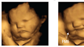 Babies in the womb smile over carrots, grimace at kale, new fetus study finds