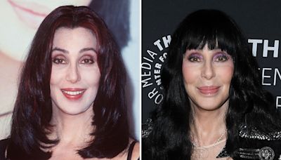 Cher’s Friends ‘Begging Her to Quit’ Getting Plastic Surgery, Fear Her Face ‘Will Cave In’