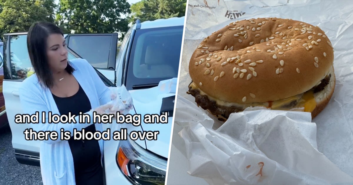 Mother finds blood in Burger King meal after daughter takes bite thinking it’s ketchup