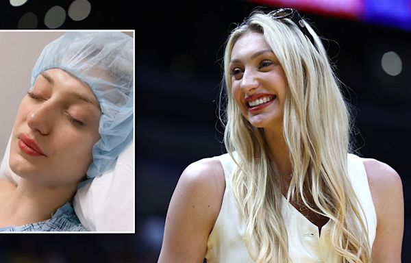 WNBA rookie Cameron Brink responds to fans saying she wore makeup post-ACL surgery