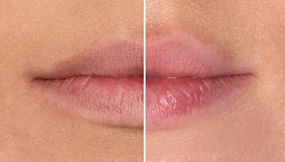 Shoppers say this volume-boosting gloss gives them a plump pout without the burn