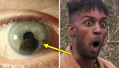 36 Wild Photos Of The Human Eye That Have Me...Well, Wide-Eyed