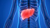 Diabetes and obesity can damage the liver to the point of failure