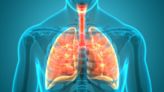 Verona prepares for anticipated US launch of ensifentrine for COPD in Q3 2024