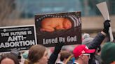 Indiana Supreme Court: Lawmakers can ban abortion except to protect mother's health