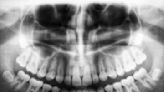 The horrors of temporomandibular joint disorders: Chronic pain, metal jaws and futile treatments