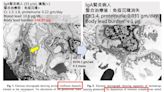 吃「吃盛唐中藥粉」8個月 她關節痛、乏力長達一個月、起疹 血鉛飆130