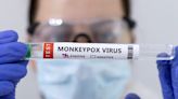 Texas relata primeira morte nos EUA de pessoa com monkeypox