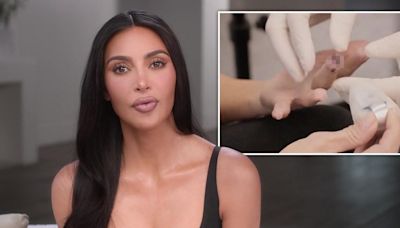 Kim Kardashian shows off seriously gruesome injury after breaking fingertip