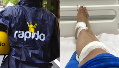 Woman Says 'Never Taking Rapido Again' After Biker Lands Her In Hospital; Here's What Company Said