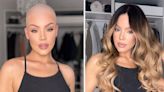 I lost my hair due to alopecia and hit rock bottom, now I design wigs for celebrities