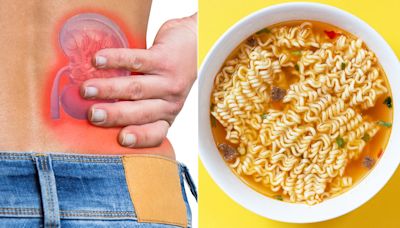 Can Eating Ramen Noodles Lead To Kidney Stones? Doctors Explain Dietary Risk Factors And Prevention Tips
