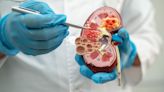 Renalys Pharma gains funding for trials of kidney disease treatments