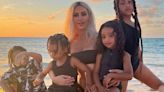 Kim Kardashian’s Son Diagnosed With Vitiligo - Know All About Skin Diseases That Cause White Patches