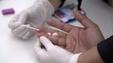 Por qué el VIH se vuelve resistente al antiviral más eficaz contra el virus