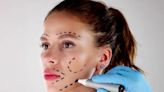 Inside the Dark, Sometimes Deadly World of Cosmetic Surgery