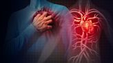 Cell Therapy Prevents Risk Of Heart Attack or Stroke: Study