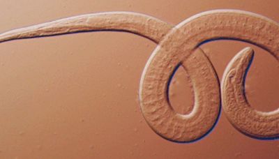 Family Reunion Left 3 People Hospitalized With Rare Parasitic Worms, CDC Reports