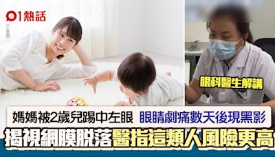 2歲仔一腳踢到媽媽視網膜脫落 眼見黑影先入院 醫生揭恐怖後果