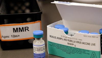 Measles warning: Sites where contagious person went in South Bay and Santa Cruz