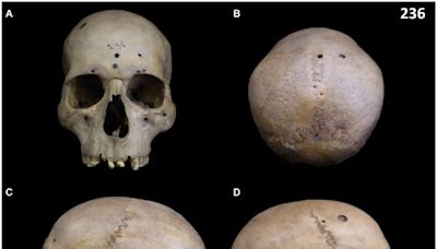 Ancient Egyptian Skull Found Riddled With Tiny Cut Marks. This Could Be Why.