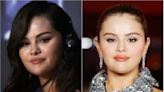 ¿Selena Gómez se hizo cirugía plástica? La cantante responde a rumores: "Déjenme en paz"