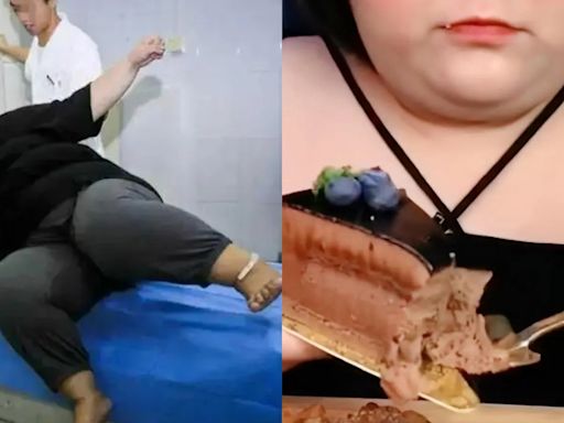 直播「暴食10KG食物」！24歲大胃王網紅猝死 驗屍報告超嚇人：胃嚴重變形