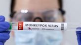 US reports at least 31 cases of monkeypox among children