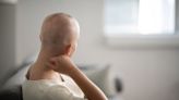 Alopecia Patients Able to Almost Fully Regrow Hair in Clinical Trials of New Pill