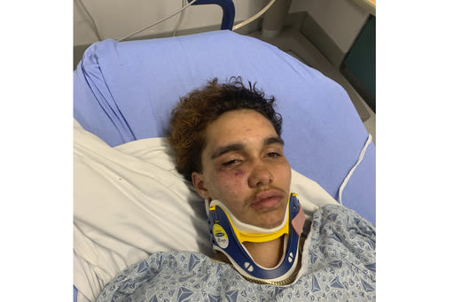 A transgender teen in Massachusetts says other high schoolers beat him at a party | ABC6