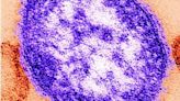 MEASLES CASES UP SHARPLY