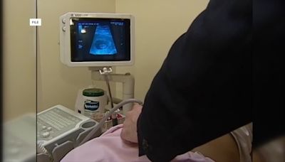 Iowa Supreme Court clears way for law banning abortion after heartbeat detection