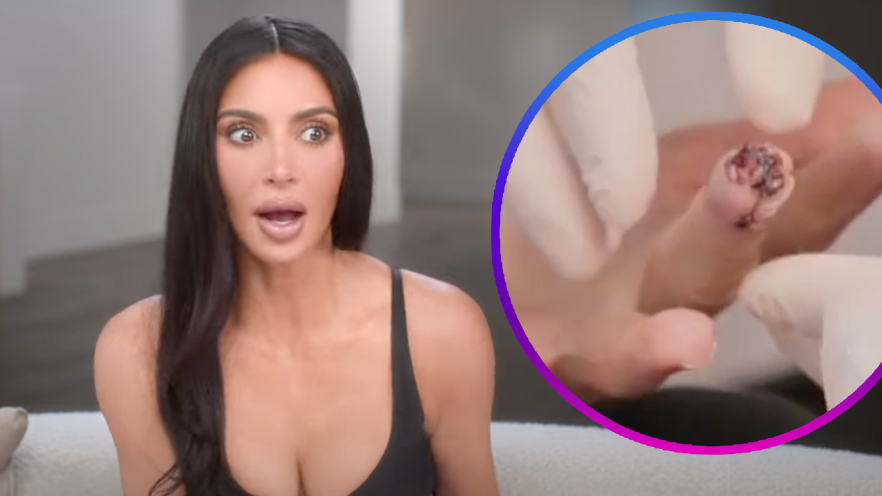 Kim Kardashian Slices Part of Her Finger Off, Says It Was 'More Painful Than Childbirth'