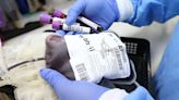 Extended Blood Typing Needed for Improving Transfusion Safety