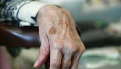 France records growing number of supercentenarians