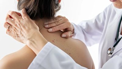 Qué es la dermatitis atópica y por qué el diagnóstico temprano mejora la calidad de vida